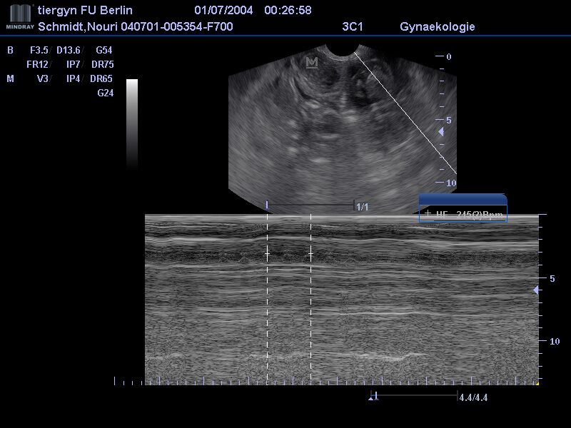 Ultraschallbild mit Herzfrequenz