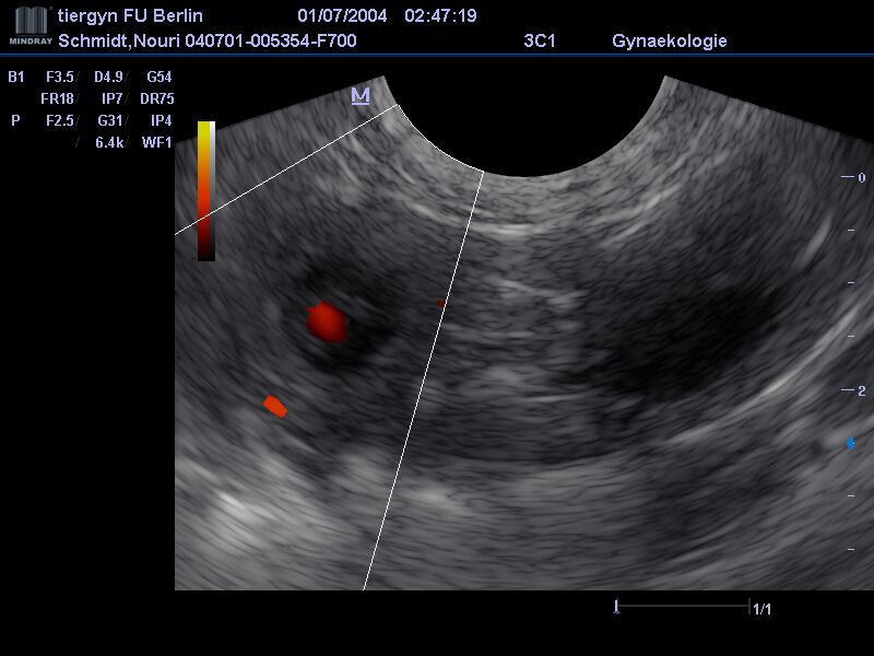 Ultraschall mit Kromi Embryonen und kleinen Herzchen